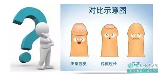 金华治疗包皮过长医院？进行包皮手术有哪些好处呢?