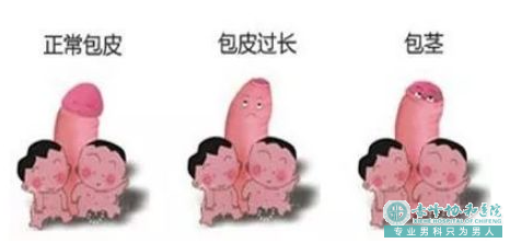 金华元宝山区哪个男子医院治疗包茎效果好？