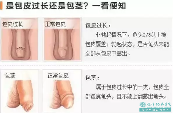 金华婺城区治疗包皮过长哪家医院比较好？